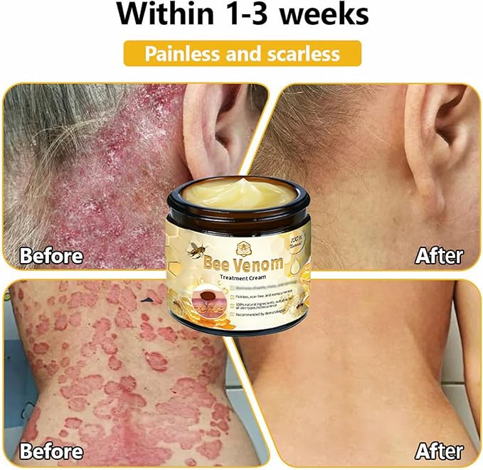 (كريم العناية بسم النحل) Bee Venom Care Cream